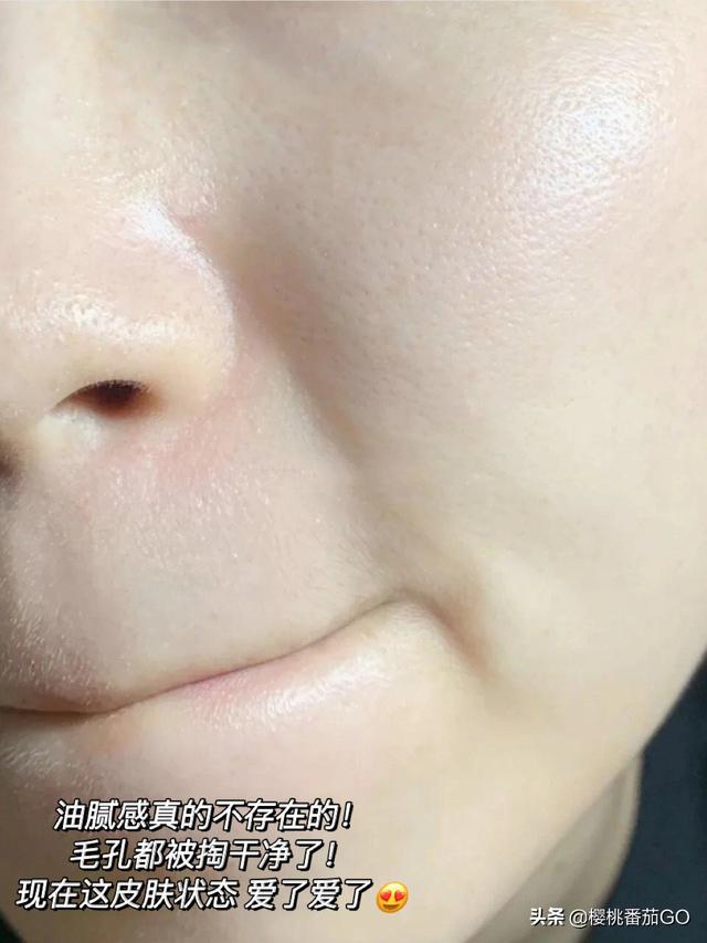 大佬们,哪个洗面奶可以有效的去除毛孔,其他app怕被自媒体骗?