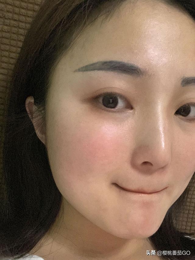15岁孩子,脸上青春痘很严重,大家有没有好的产品推荐一下呢?