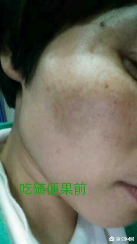 有哪些适合熬夜去黄的护肤品?