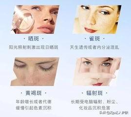 脸上的色斑是怎么长出来的?