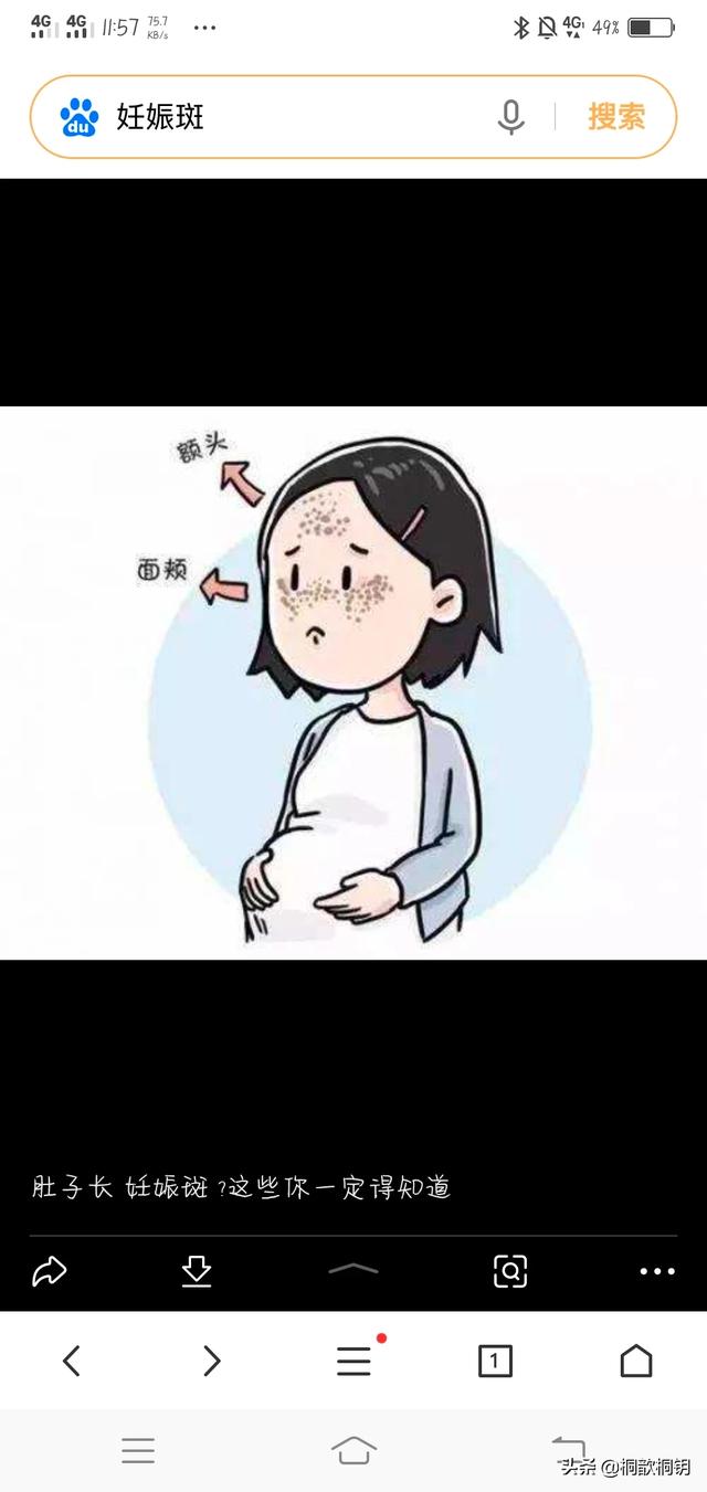 脸上的色斑是怎么长出来的?