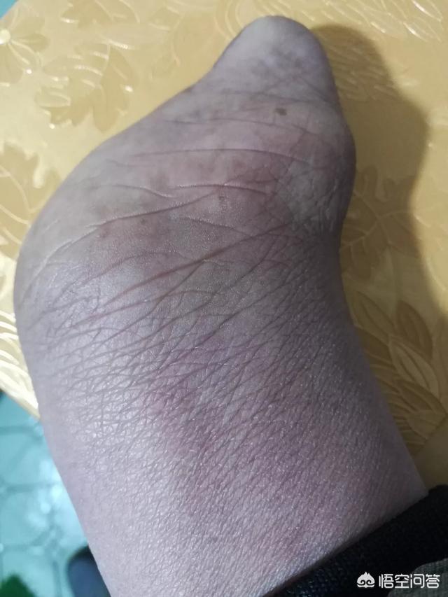 残疾人可以提前拿到养老金吗?
