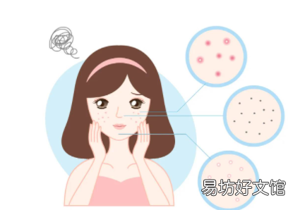 痤疮可以吃苦瓜吗