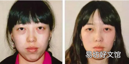 冬瓜贴眼袋有什么好处