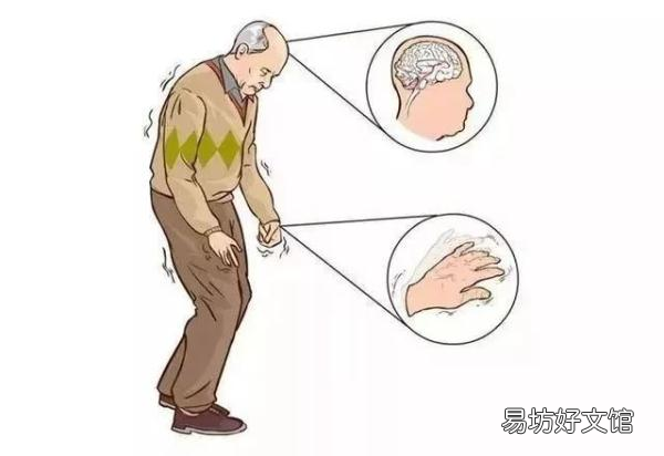 中风的九个前兆症状