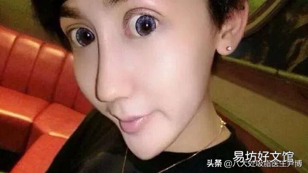 为什么现在有些女孩天生已经很漂亮了,还非要把下巴整成锥子形?