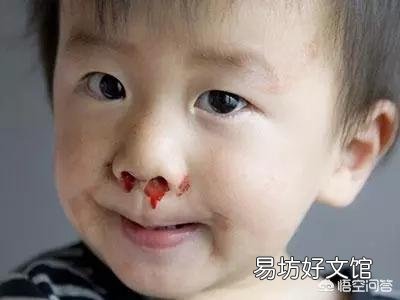 小孩老流鼻血是什么原因引起的?该怎么办?