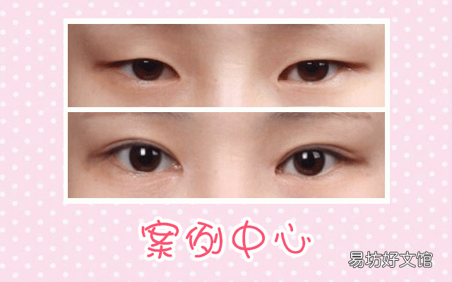 怎样让眼睛变大？