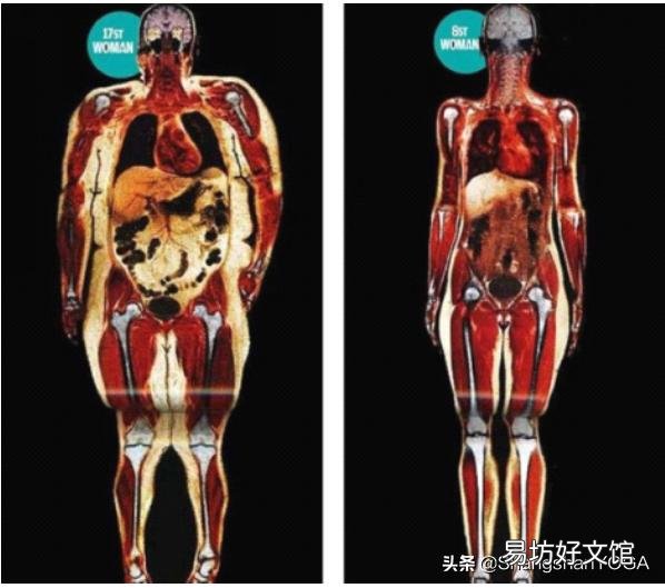体脂率26,应该是先减脂还是先健身?