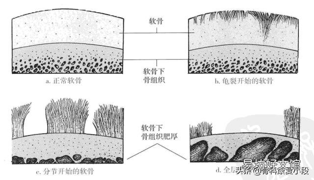 怎样锻炼膝盖增加骨液?