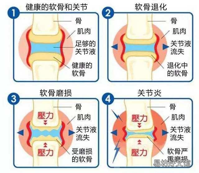 怎样锻炼膝盖增加骨液?