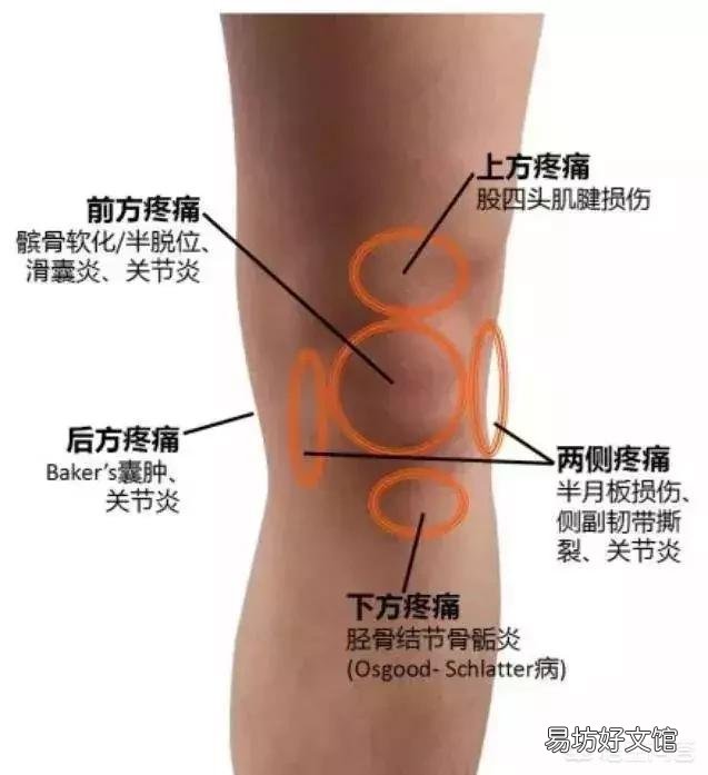 跑步膝盖疼痛是怎么回事？