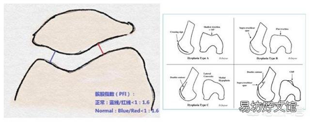 做完深蹲后膝盖髌骨疼，应该怎么缓解？