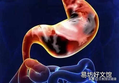 哪些食物对胃病不好？