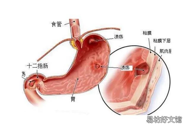 哪些食物对胃病不好？