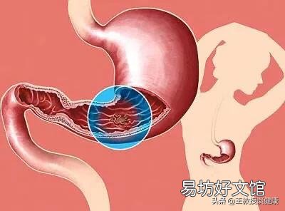 哪些食物对胃病不好？
