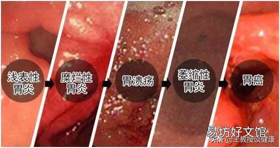 哪些食物对胃病不好？