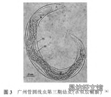 螺类可以随便吃 ， 对人体健康影响不大？