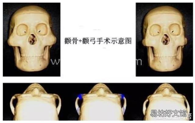 自己的脸型不好看,线条不流畅,显得很刻薄,应该怎么改善?