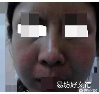 自己的脸型不好看,线条不流畅,显得很刻薄,应该怎么改善?