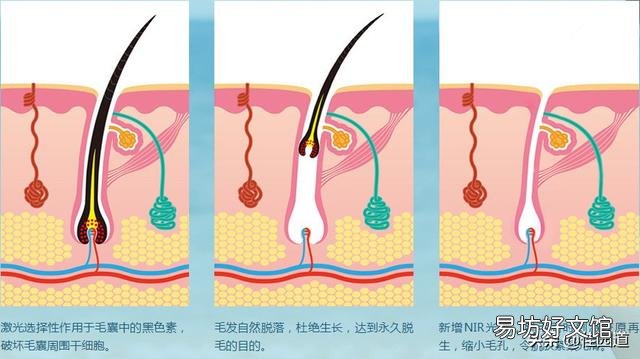 最简单的脱毛方法是哪个呢?
