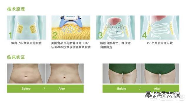 冷冻溶脂适合微胖的人吗？