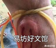 五步蛇具有很好的保护色,难以被发现,假如在农村山上干活被五步蛇咬了怎么办?
