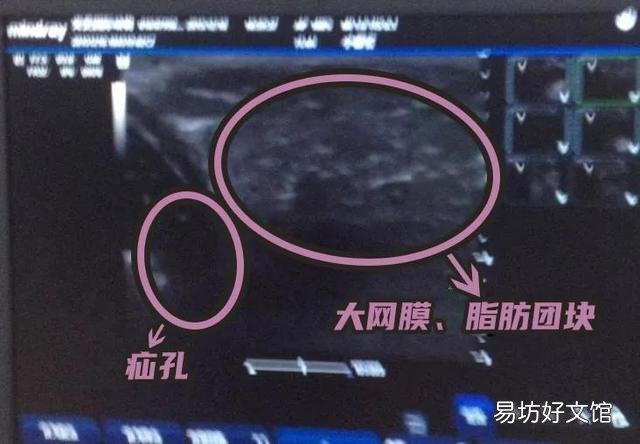 母猫涨奶硬块多久会消(小猫断奶母猫涨奶硬块多久会消)