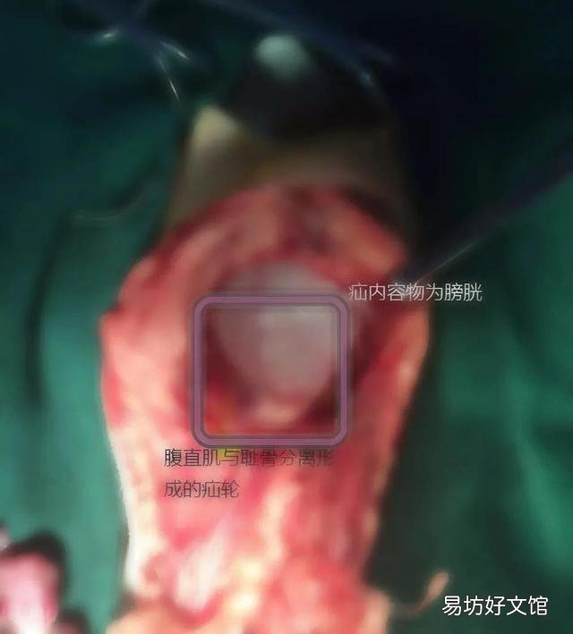 母猫涨奶硬块多久会消(小猫断奶母猫涨奶硬块多久会消)