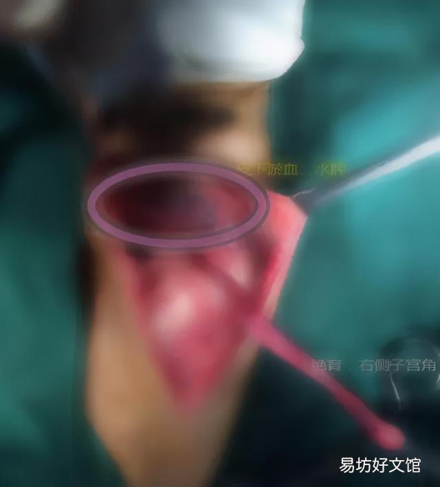 母猫涨奶硬块多久会消(小猫断奶母猫涨奶硬块多久会消)