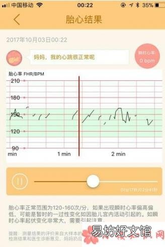 mommytouch胎心监测仪靠谱吗 mommytouch胎心检测仪怎么样