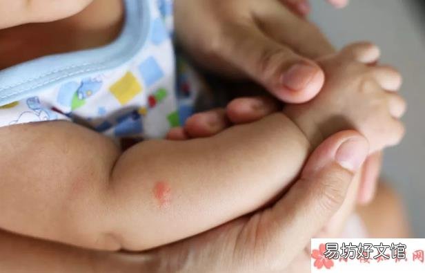 林可霉素和利多卡因凝胶宝宝会过敏吗 绿药膏多大的宝宝能用
