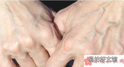 蚂蚁庄园3月3日答案 为什么透过皮肤看静脉血管是蓝色