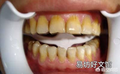 天天都刷牙,为什么牙齿还是黄黄的?