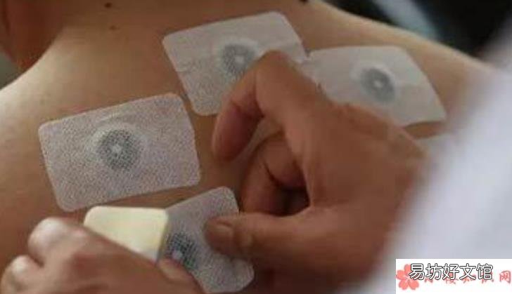 自己做的三伏贴怎么贴2018 自己做三伏贴买什么药材