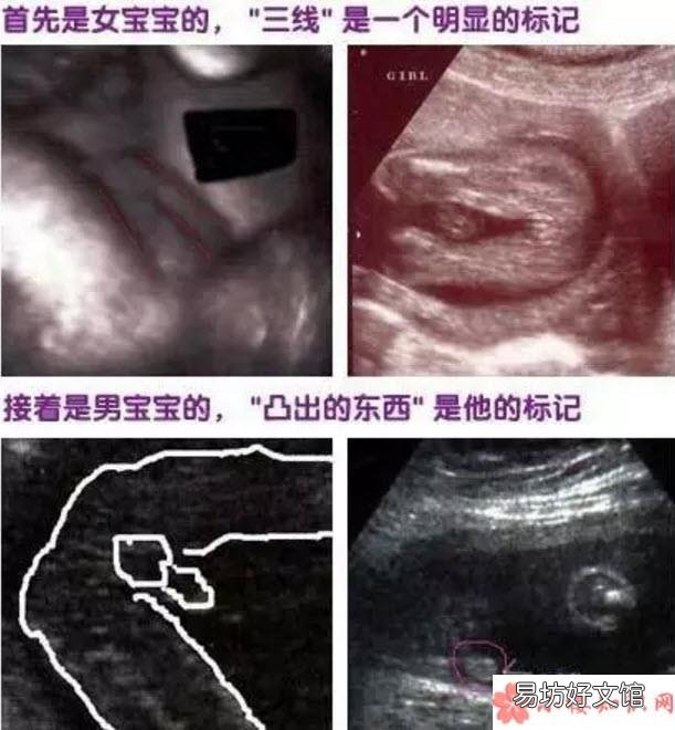 第二胎生男生女早知道小妙招 二胎生男生女早知道