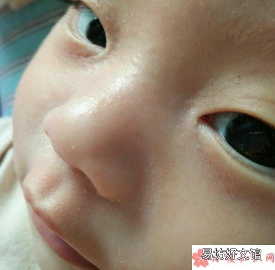 松达山茶油儿童面霜对湿疹有效果吗 松达山茶油儿童面霜怎么样
