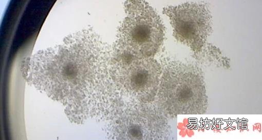 打了达必佳小孩能要吗 打达必佳期间发现怀孕了怎么办