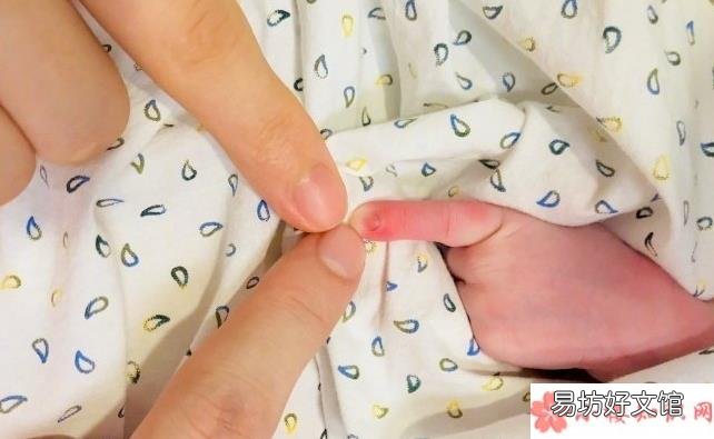 新生兒手指硬掰有哪些影響 如何正確曬新生兒