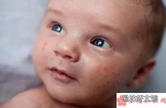 婴儿防过敏奶粉怎么选择 婴儿奶粉过敏怎么选择奶粉