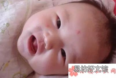 宝宝被蚊子咬了怎么办 防蚊有哪些误区