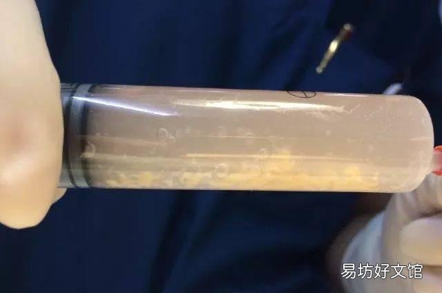 猫传腹最明显的症状(猫传腹最明显的症状图片)