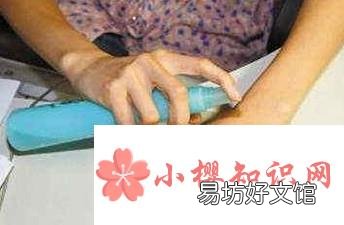 夏天被蚊子咬怎么快速止痒