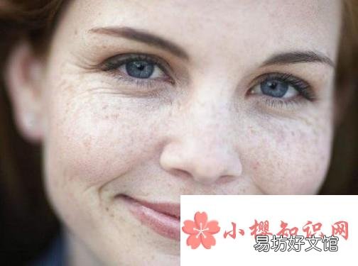 脸上长黑色素怎么办