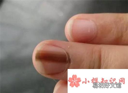 女性如何减少指甲油对身体的危害?