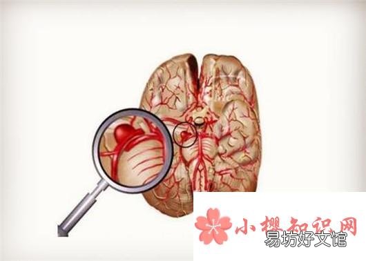 总是犯困睡不醒是怎么回事?该如何调整?