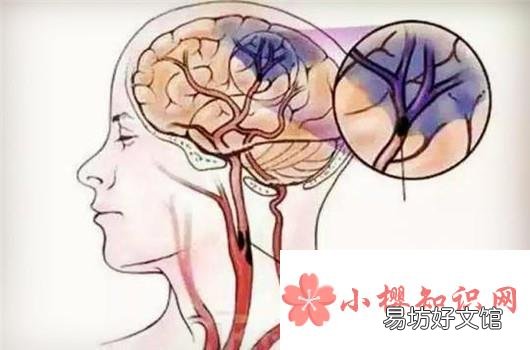 总是犯困睡不醒是怎么回事?该如何调整?