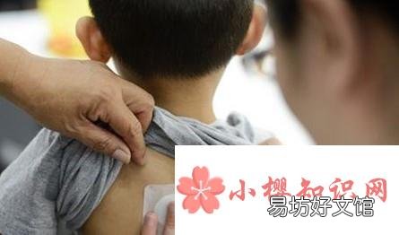儿童贴三伏贴要注意什么