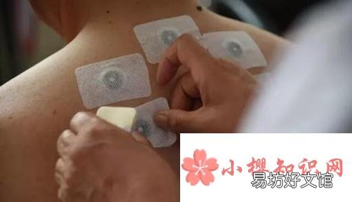 儿童贴三伏贴要注意什么