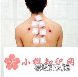 儿童贴三伏贴要注意什么